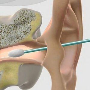 Remoção de Cerumen R$40